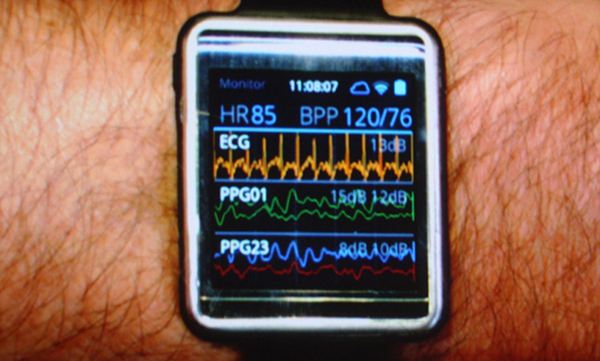 Simband Samsung 02