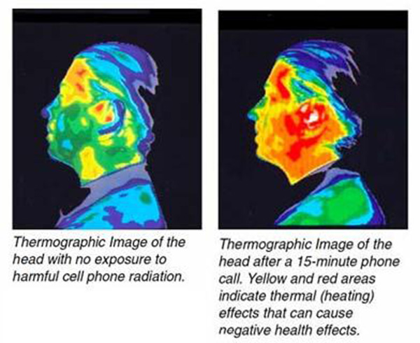 mobile phone radiation