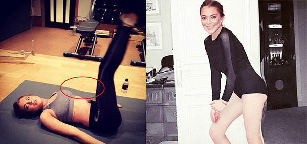 Los peores retoques de Photoshop del 2015 12 Photoshop-fails-2015-15