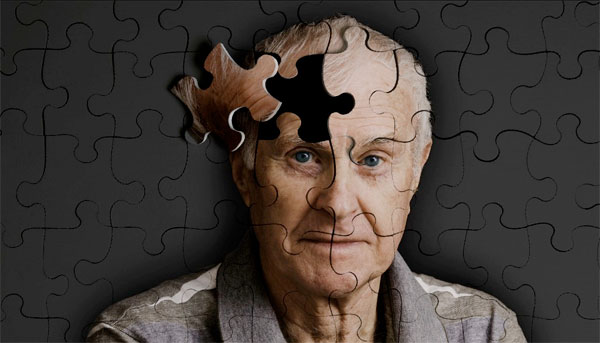 En 3 años empezarán a probar en humanos la primera vacuna contra el Alzheimer 2 alzheimer2