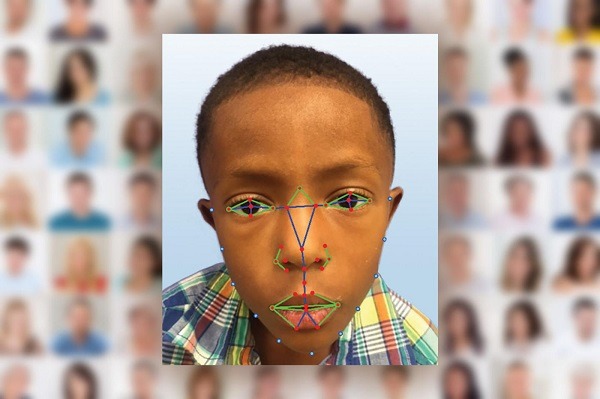 El reconocimiento facial permitirá detectar una enfermedad genética