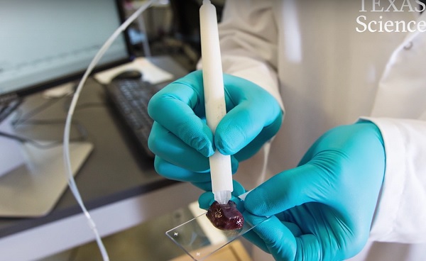 Este lápiz es capaz de detectar el cáncer en 10 segundos