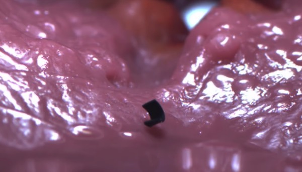 En acción el nano robot que puede moverse dentro de tu cuerpo 1 microrobot