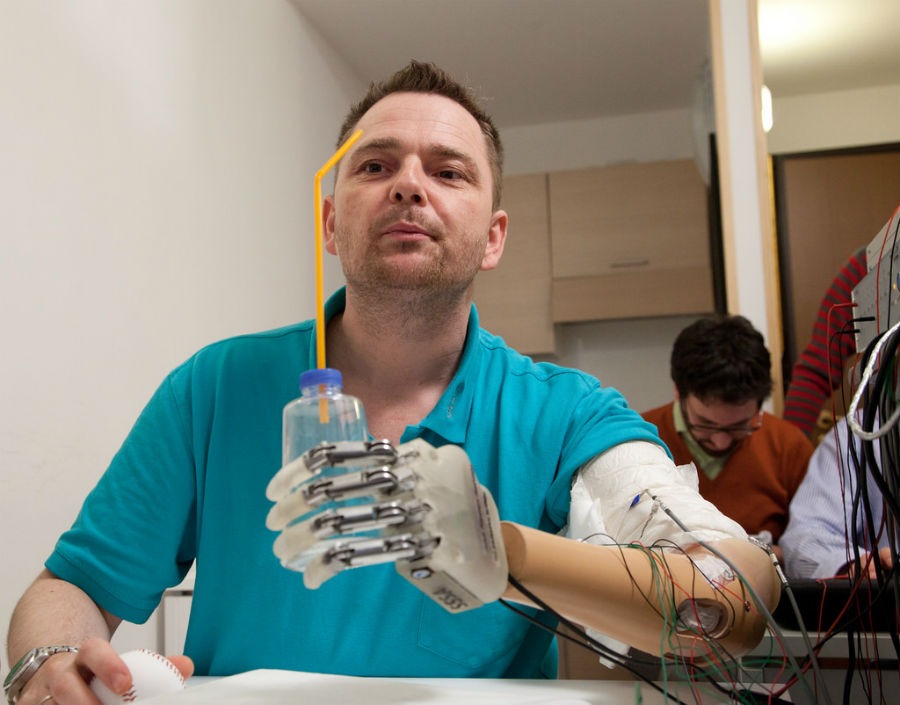 Разработчик киберпротезов и имплантатов презентация