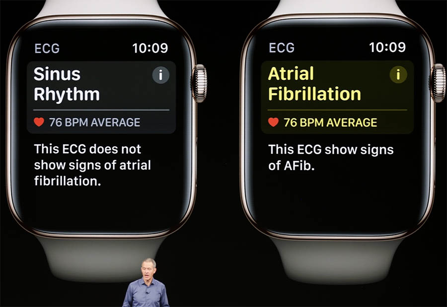 apple watch electrocardiograma