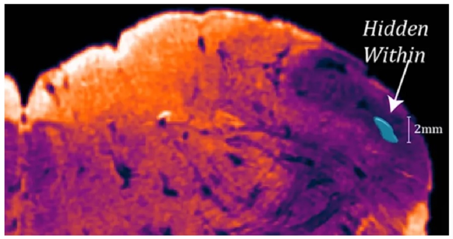 Científicos descubren una parte todavía desconocida del cerebro 2 cerebro