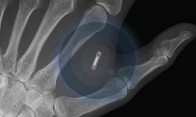 Dangerous Things, la inquietante web de accesorios para convertirte en un cyborg