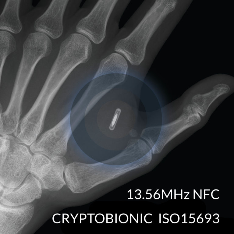 Dangerous Things, la inquietante web de accesorios para convertirte en un cyborg 2 Implantes de transpondedor RFID y NFC