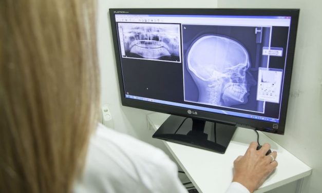 Peligro: 53.000 radiografías españolas listas para piratear
