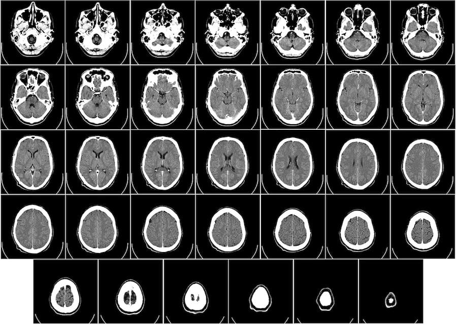 radiografias filtradas espana 1